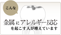 こんな金属アレルギー反応を起こす人が増えています